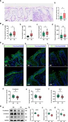 Gut Dysbiosis Is Associated With the Severity of Cryptogenic Stroke and Enhanced Systemic Inflammatory Response